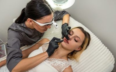 Les bienfaits de l’épilation haute tension pour les peaux sensibles ?