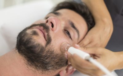 Contour de barbe parfait : pourquoi le laser remplace le rasage quotidien