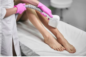 Le laser pour les adolescents : À partir de quel âge commencer ?