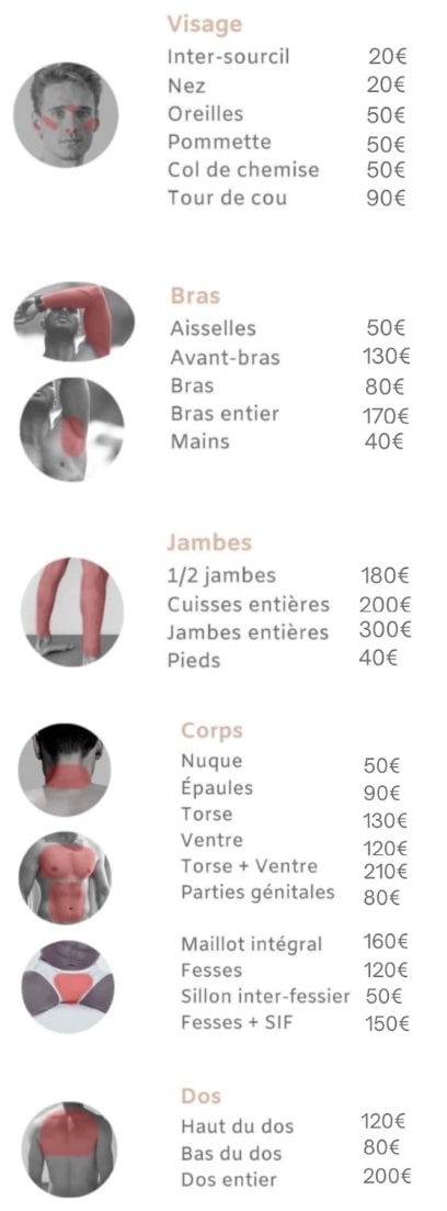 Tarif épilation laser homme