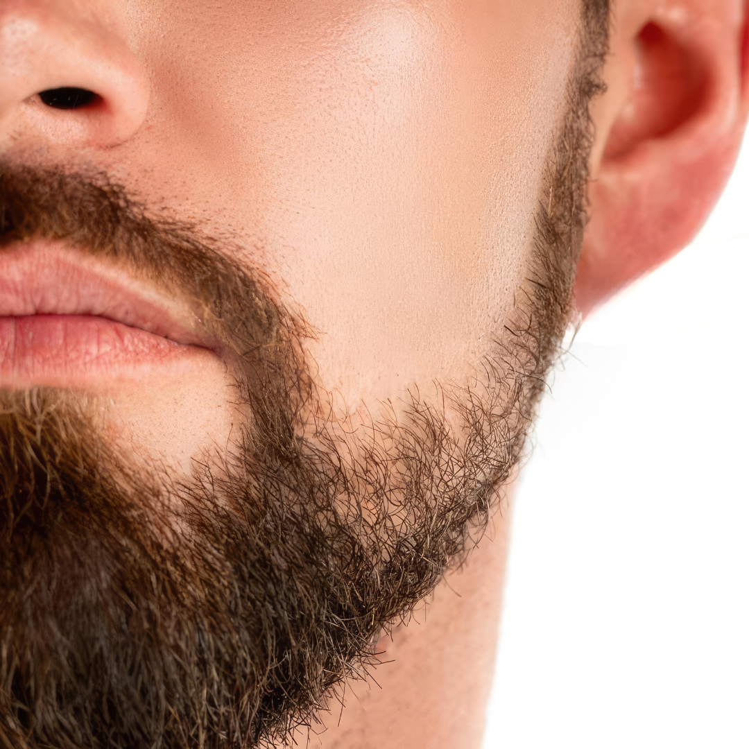 epilation laser homme barbe
